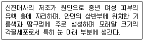 미용사(네일) 2016년 3회 18번 문제 그림