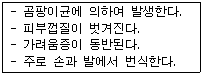 미용사(피부) 2009년 4회 25번 문제 그림