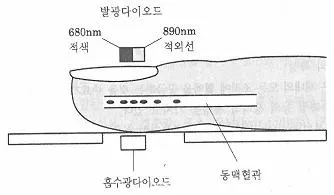의료전자기능사 2013년 1회 5번 문제 그림