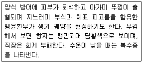 수산양식기사 2012년 1회 94번 문제 그림