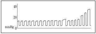소방공무원(경력) 응급처치학개론 2023년 1회 12번 문제 그림