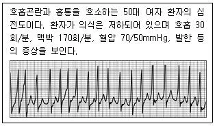 소방공무원(경력) 응급처치학개론 2024년 1회 19번 문제 그림
