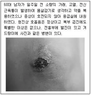 소방공무원(경력) 응급처치학개론 2024년 1회 38번 문제 그림