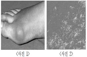 소방공무원(경력) 응급처치학개론 2026년 1회 33번 문제 그림