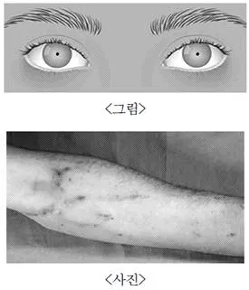 소방공무원(경력) 응급처치학개론 2026년 1회 35번 문제 그림