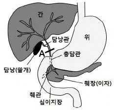 변리사 1차(3교시) 2017년 1회 25번 문제 그림